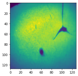 ../_images/notebooks_WSI_brain_5_2.png